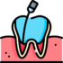 root-canal